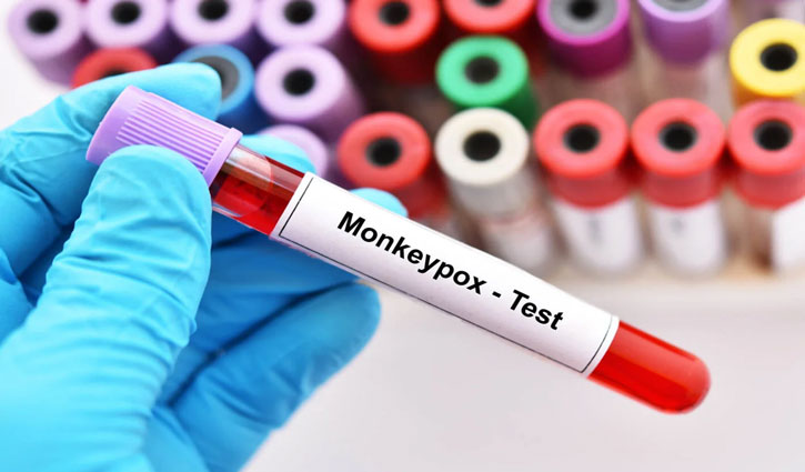 Fifth monkeypox patient in Delhi, woman traveling to Nigeria reports positive
