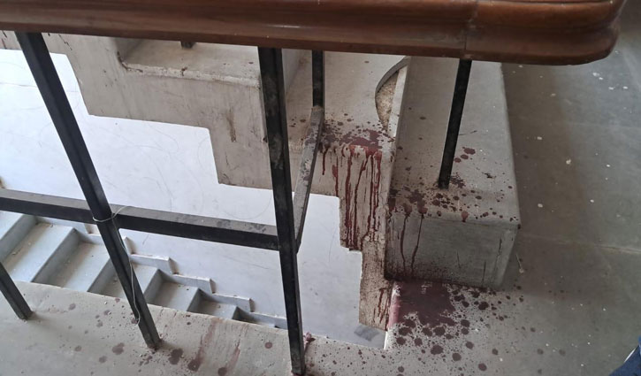 Blood stained cloth, blood marks, knife found in Atiq Ahmed's office; Forensic team is investigating
