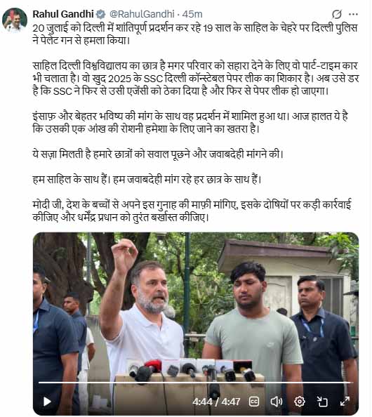 "Stop Lying": Pellet Victim By His Side, Rahul Gandhi Targets Centre