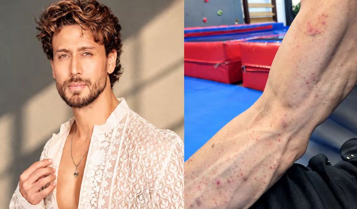 Following the shooting incident in Mumbai, Tiger Shroff's team shared the first video of his injured hand.